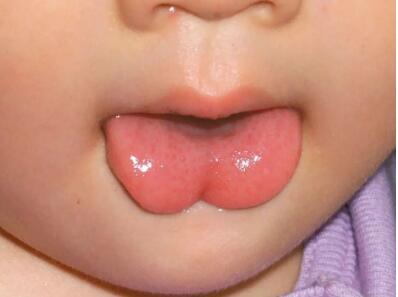 宝宝舌头的健康“晴雨表”，你会看吗？